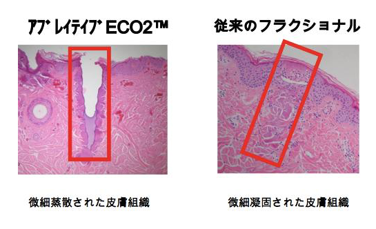 eco2皮膚